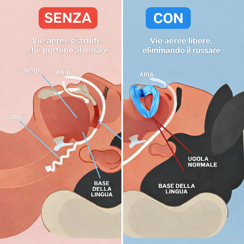 Bite anti-russamento